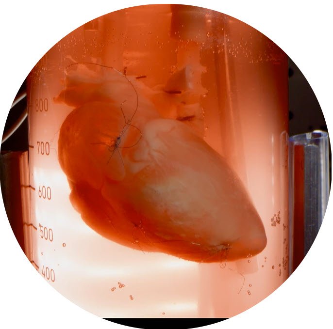 From Growing Hearts in the Lab<br>To Personalized Supplementation:<br>Key Learnings From Abundance 360