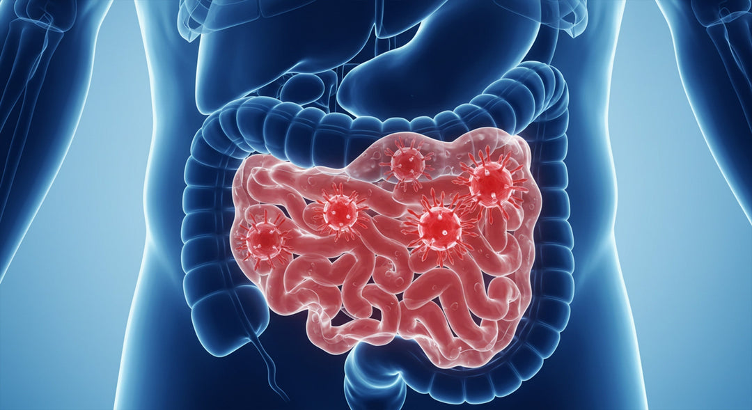 Is Something Hiding in Your Gut? <br>What You Need to Know About Stealth Pathogens