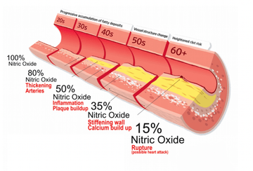 N1O1 Nitric Oxide Lozenge | Dr. Tennant's Nutraceuticals for Heart ...